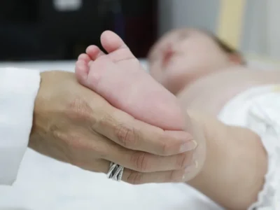 Atraso no teste do pezinho atrasa diagnóstico e tratamento da AME no SUS